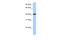 C2D1B antibody, A10756, Boster Biological Technology, Western Blot image 