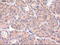 Patched 1 antibody, GTX83771, GeneTex, Immunohistochemistry paraffin image 