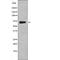 Potassium Voltage-Gated Channel Subfamily D Member 2 antibody, PA5-64525, Invitrogen Antibodies, Western Blot image 