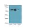 Serine Palmitoyltransferase Long Chain Base Subunit 3 antibody, A67314-100, Epigentek, Western Blot image 