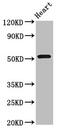 Regulator Of G Protein Signaling 6 antibody, CSB-PA019658LA01HU, Cusabio, Western Blot image 