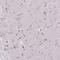 Nucleolar Protein Interacting With The FHA Domain Of MKI67 antibody, NBP2-48643, Novus Biologicals, Immunohistochemistry paraffin image 