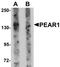 Platelet Endothelial Aggregation Receptor 1 antibody, LS-C115929, Lifespan Biosciences, Western Blot image 