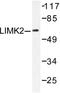 LIM Domain Kinase 2 antibody, LS-C176107, Lifespan Biosciences, Western Blot image 