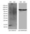 Cyclin Dependent Kinase Inhibitor 2C antibody, M03299, Boster Biological Technology, Western Blot image 