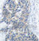Stathmin 1 antibody, AP0221, ABclonal Technology, Immunohistochemistry paraffin image 