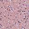 Stathmin 1 antibody, orb74844, Biorbyt, Immunohistochemistry paraffin image 