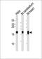 NADH:Ubiquinone Oxidoreductase Core Subunit S7 antibody, MBS9203560, MyBioSource, Western Blot image 