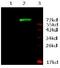 Androgen Receptor antibody, GTX16032, GeneTex, Western Blot image 