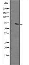 Guanylate Binding Protein 2 antibody, orb335309, Biorbyt, Western Blot image 