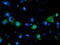 Solute Carrier Family 7 Member 8 antibody, M04381-2, Boster Biological Technology, Immunofluorescence image 