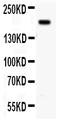 Integrin Subunit Beta 4 antibody, PA1702-2, Boster Biological Technology, Western Blot image 