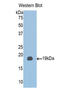Chloride Intracellular Channel 4 antibody, LS-C293308, Lifespan Biosciences, Western Blot image 
