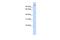 Thioredoxin Domain Containing 16 antibody, A16468, Boster Biological Technology, Western Blot image 