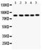 Forkhead Box M1 antibody, LS-C344045, Lifespan Biosciences, Western Blot image 