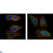 AKT Serine/Threonine Kinase 2 antibody, LS-C812493, Lifespan Biosciences, Western Blot image 