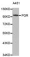 Progesterone Receptor antibody, abx001717, Abbexa, Western Blot image 