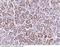 Insulin Like Growth Factor Binding Protein 4 antibody, 90080-T24, Sino Biological, Immunohistochemistry paraffin image 