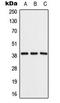 Aldolase, Fructose-Bisphosphate B antibody, LS-C353888, Lifespan Biosciences, Western Blot image 