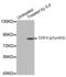 Signal Transducer And Activator Of Transcription 4 antibody, AHP2687, Bio-Rad (formerly AbD Serotec) , Western Blot image 