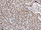 THO Complex 7 antibody, CSB-PA876114, Cusabio, Immunohistochemistry paraffin image 