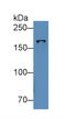 DNA Topoisomerase II Beta antibody, LS-C296718, Lifespan Biosciences, Western Blot image 