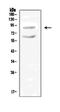 Solute Carrier Family 9 Member A2 antibody, PA2219, Boster Biological Technology, Western Blot image 