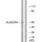 Transmembrane Protein 237 antibody, A11665, Boster Biological Technology, Western Blot image 