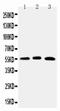 One Cut Homeobox 1 antibody, LS-C313311, Lifespan Biosciences, Western Blot image 