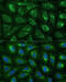 ATP Binding Cassette Subfamily D Member 2 antibody, 16-387, ProSci, Immunofluorescence image 