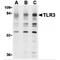 Toll Like Receptor 3 antibody, MBS150093, MyBioSource, Western Blot image 
