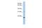 C-Type Lectin Like 1 antibody, GTX45589, GeneTex, Western Blot image 