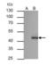 CCAAT Enhancer Binding Protein Alpha antibody, GTX100674, GeneTex, Immunoprecipitation image 