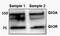 Zinc finger protein GLI3 antibody, NBP2-29627, Novus Biologicals, Western Blot image 