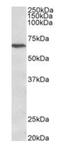 Calcium Voltage-Gated Channel Auxiliary Subunit Beta 2 antibody, orb12984, Biorbyt, Western Blot image 