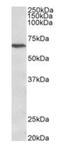 Calcium Voltage-Gated Channel Auxiliary Subunit Beta 2 antibody, orb12984, Biorbyt, Western Blot image 