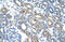 Radical S-adenosyl methionine domain-containing protein 2 antibody, ARP42696_T100, Aviva Systems Biology, Immunohistochemistry paraffin image 