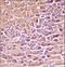 Protein Kinase CAMP-Activated Catalytic Subunit Beta antibody, LS-C164545, Lifespan Biosciences, Immunohistochemistry paraffin image 