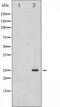 Thymidine Kinase 1 antibody, TA325943, Origene, Western Blot image 