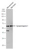 Synaptotagmin 1 antibody, GTX103641, GeneTex, Western Blot image 