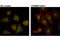 Forkhead Box O3 antibody, 12829S, Cell Signaling Technology, Immunocytochemistry image 