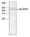 Aldehyde Dehydrogenase 2 Family Member antibody, MBS857930, MyBioSource, Western Blot image 