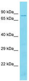 TBC1 Domain Family Member 17 antibody, TA330745, Origene, Western Blot image 