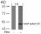 Vasodilator Stimulated Phosphoprotein antibody, GTX50253, GeneTex, Western Blot image 