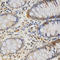 Midkine antibody, LS-B14850, Lifespan Biosciences, Immunohistochemistry frozen image 
