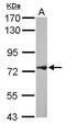 Phospholipase A2 Group IVF antibody, GTX120597, GeneTex, Western Blot image 