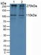 Insulin Like Growth Factor 2 Receptor antibody, LS-C294646, Lifespan Biosciences, Western Blot image 