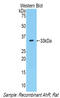 Aryl Hydrocarbon Receptor antibody, LS-C294034, Lifespan Biosciences, Western Blot image 
