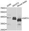 NAD-dependent ADP-ribosyltransferase sirtuin-4 antibody, LS-C349258, Lifespan Biosciences, Western Blot image 