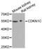 Cyclin Dependent Kinase Inhibitor 1C antibody, MBS128005, MyBioSource, Western Blot image 